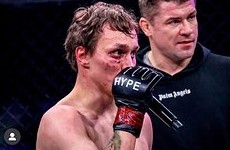 Бойцу ММА удалили глаз после конфликта с девушкой - «Бокс и ММА»